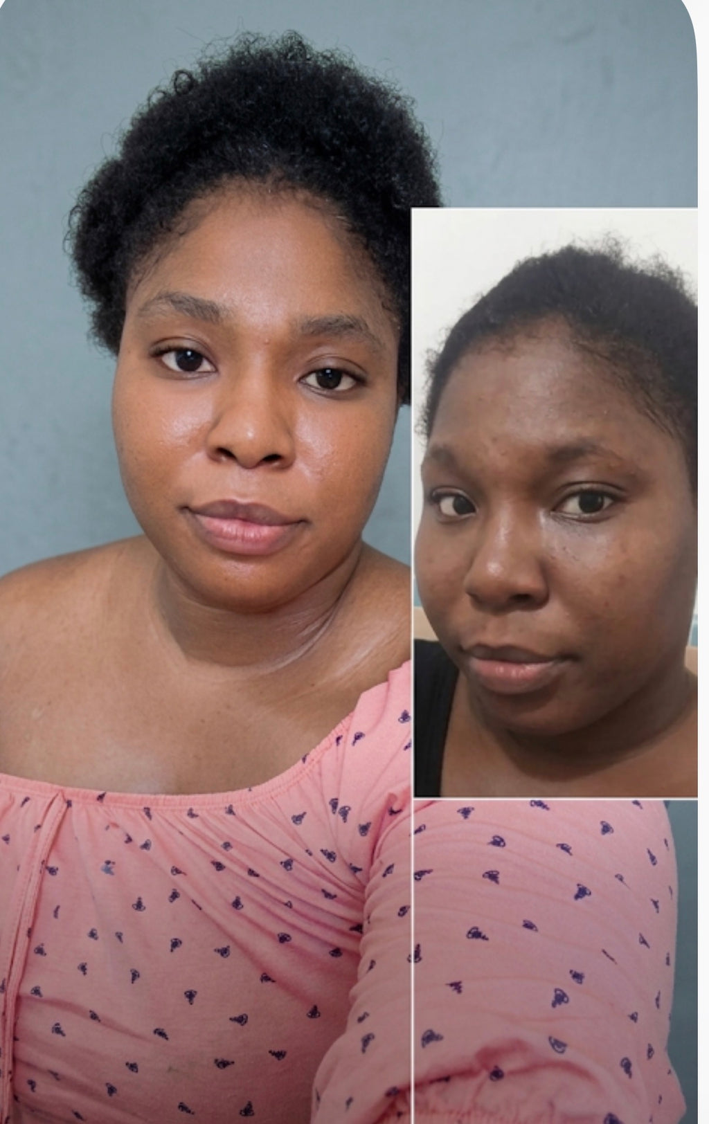 African black soap 3x kojic