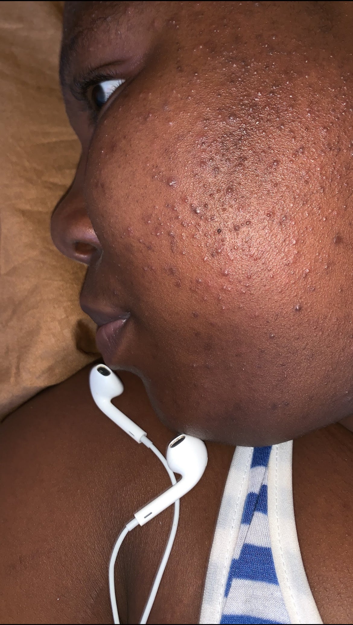 Papaya brightening soap